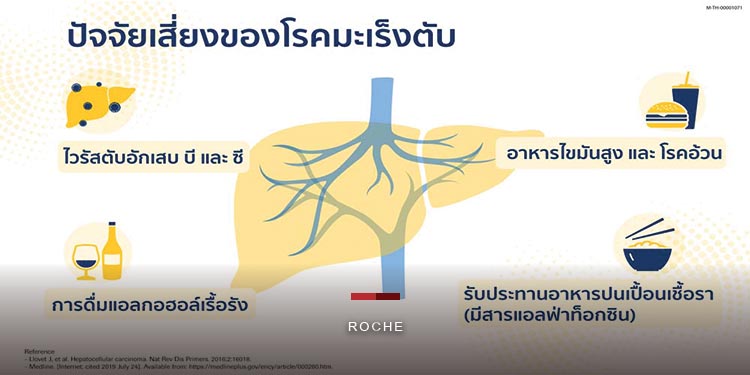 มะเร็งตับ ดับชีวิตคนไทย 73 รายต่อวันพุ่งสูงกว่าโควิด 26 เท่า/ปี