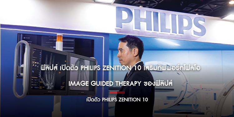 ฟิลิปส์ เปิดตัว Philips Zenition 10 เสริมทัพพอร์ทโฟลิโอ Image Guided Therapy ของฟิลิปส์