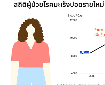 มะเร็งปอดเกิดได้ในผู้หญิงแม้ไม่สูบบุหรี่:  โรช เน้นย้ำการตรวจคัดกรอง เพื่อการรักษาที่ได้ผล ตรวจไว รู้เร็ว มะเร็งปอดรักษาได้