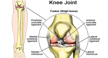 Osteoarthritis of the knee